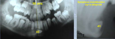 Probleme 43 x0gsxm - Eugenol