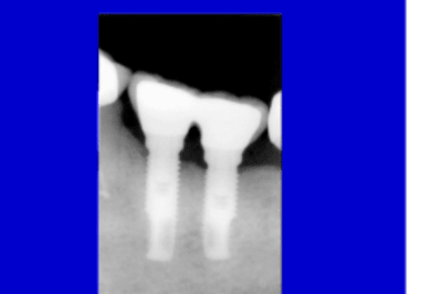 Projet2 isxzkr - Eugenol
