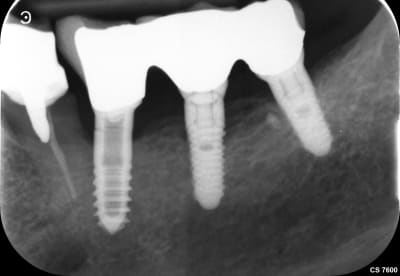 Quintin yves 20190731 085541 edzmgm - Eugenol