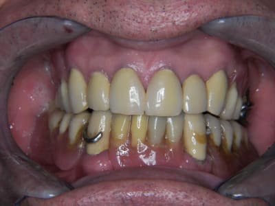 Qu 83 tmpp2y - Eugenol