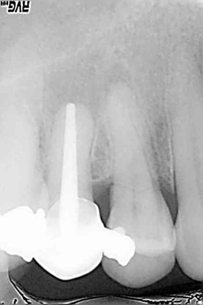 R15 iiobgg - Eugenol