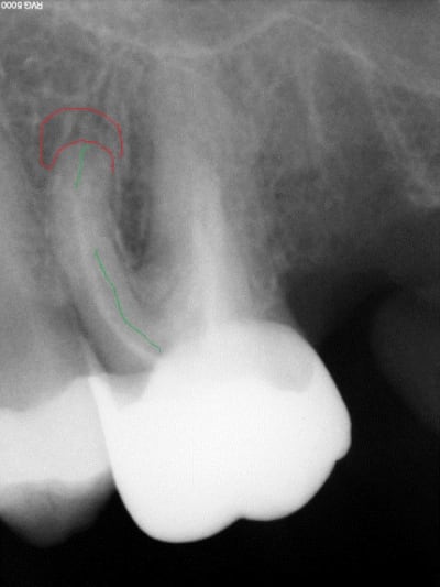 R16d cotfhf - Eugenol