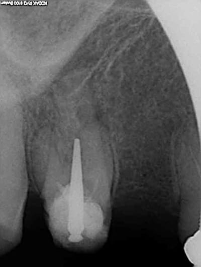 R1 fk2lma - Eugenol