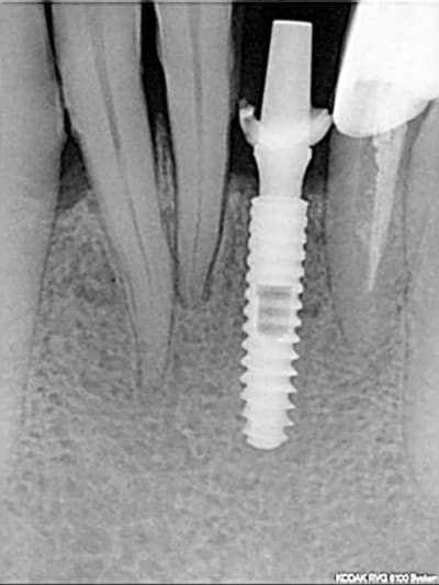 R22 t5osxv - Eugenol