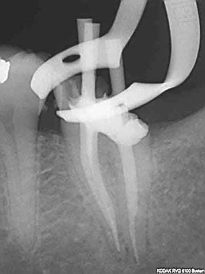 R26 z7pbas - Eugenol