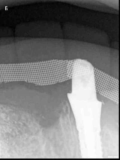 R33 yxsp3b - Eugenol