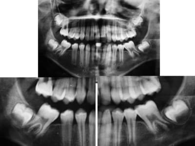 Radios j2kpzi - Eugenol