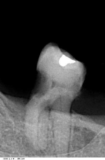 Radio kusung - Eugenol