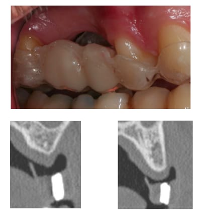 Rog zthe7z - Eugenol