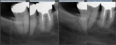 Rvg ajqeix - Eugenol