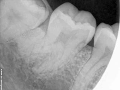 Rvg uyjkl2 - Eugenol