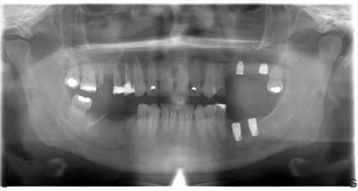 Rx01 xyj5xv - Eugenol