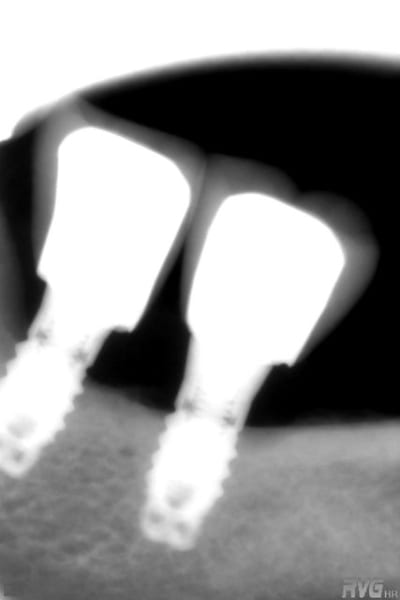 R 2 copy ybn8mr - Eugenol