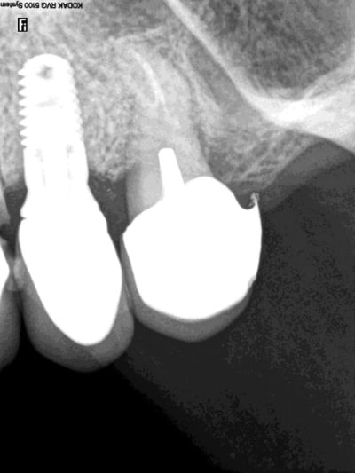 R catherine 25 fwj6le - Eugenol