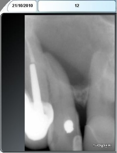 Rx 11 12 vdj29d - Eugenol