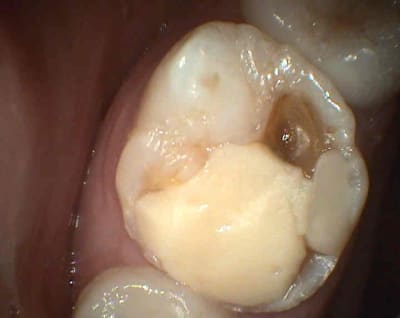 S10 lgqksm - Eugenol