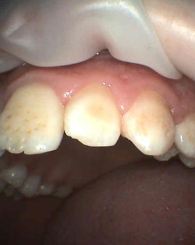 S5 ehfmqw - Eugenol