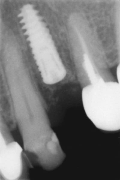 Second temps chir ao5oqz - Eugenol