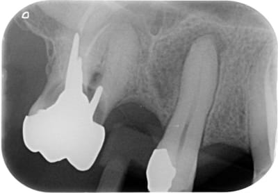 Secteur1 post fto2ja - Eugenol