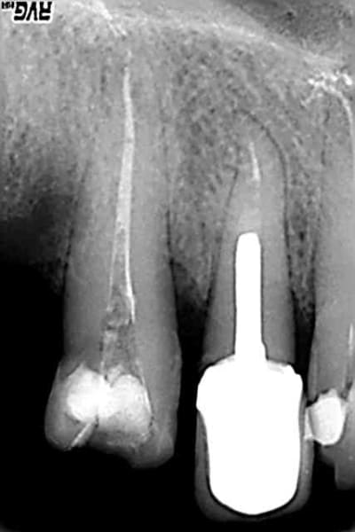 Sel1 hyvyl1 - Eugenol