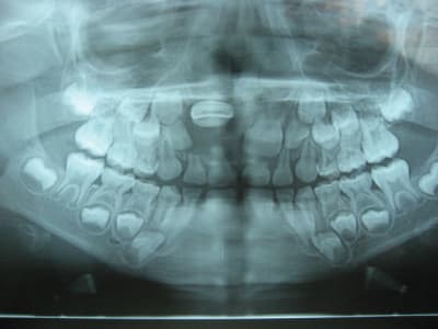 Serra maeline aout09 dry6cd - Eugenol