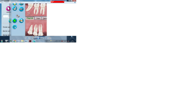 Saisie acte bu7oc6 - Eugenol