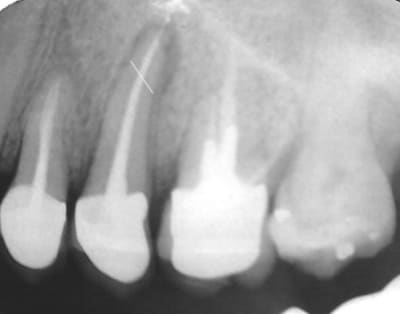 Sans titre 1 dbcbmp - Eugenol