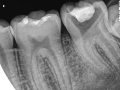 Sans titre2 nttp0n - Eugenol