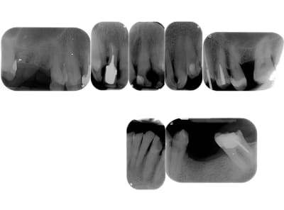 Sans titre2 tawltr - Eugenol