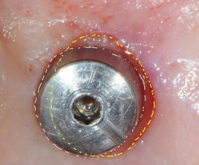 Sans titre erxoln - Eugenol