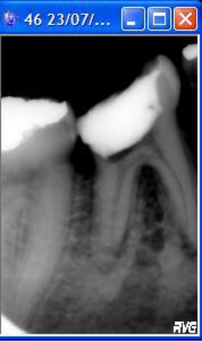 Sans titre hp03rj - Eugenol