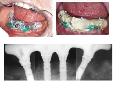 Sans titre ssfcma - Eugenol