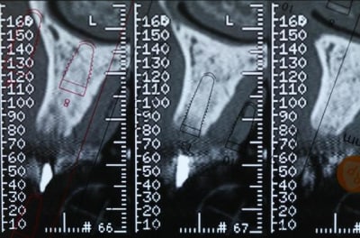 Scann22 ykmyyi - Eugenol