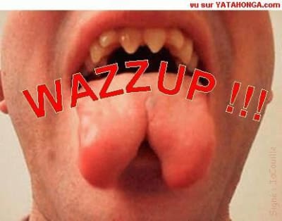 Se fendre la gueule dwjbx4 - Eugenol