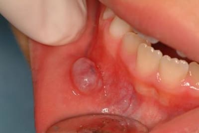 Stéphane 001 tjd0ec - Eugenol