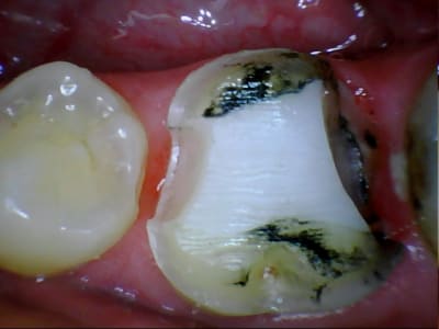 Stillcap0026 wp3kjt - Eugenol