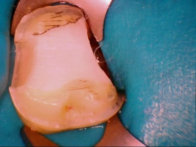 Stillcap0027 syhcuy - Eugenol