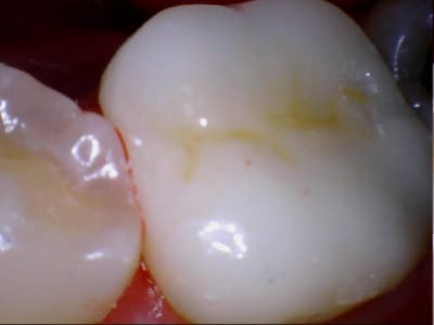 Stillcap0031 xafll3 - Eugenol