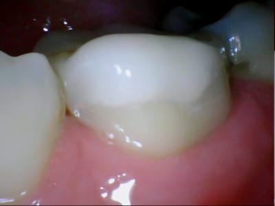 Stillcap0034 hdmh4r - Eugenol