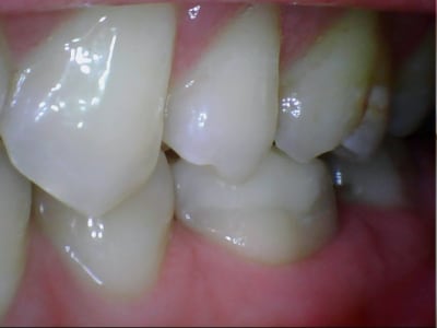 Stillcap0036 ednvzn - Eugenol