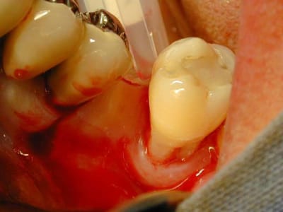 Summerstime1 dffnnc - Eugenol