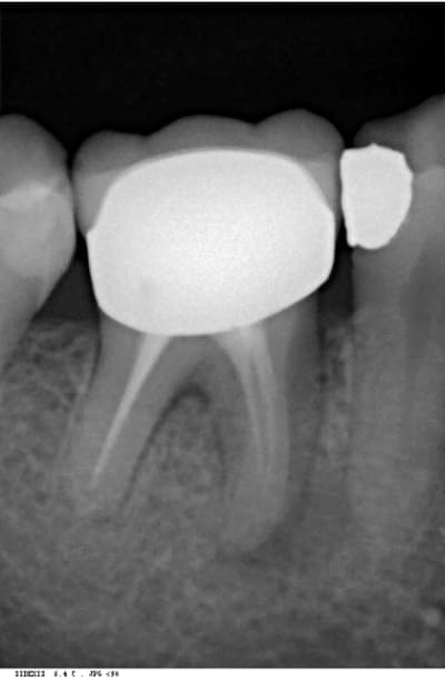 Trev1 rgpu7x - Eugenol
