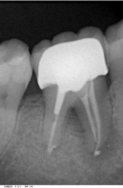 Trev3 wgcbda - Eugenol