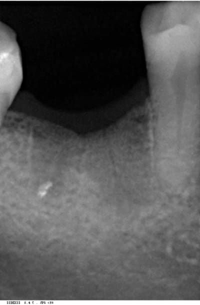 Trev4 oye2tl - Eugenol