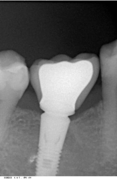 Trev5 lavbuq - Eugenol