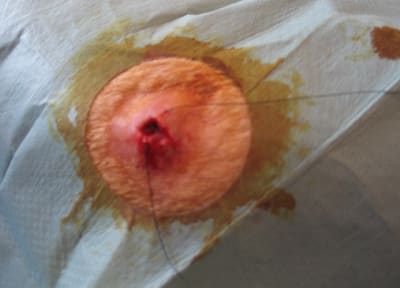 Tara 3 seqcaw - Eugenol