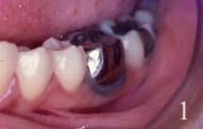 Tatouage 1 pwbxa7 - Eugenol