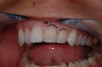 Teix correction avt msf2ne - Eugenol