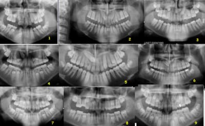 Test canines nkm3xj - Eugenol