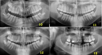 Test canines suite et fin ljwpc0 - Eugenol